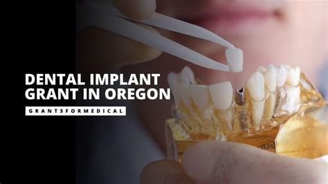 free dental implants in oregon.